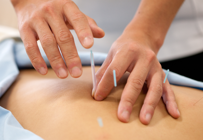 鍼灸施術